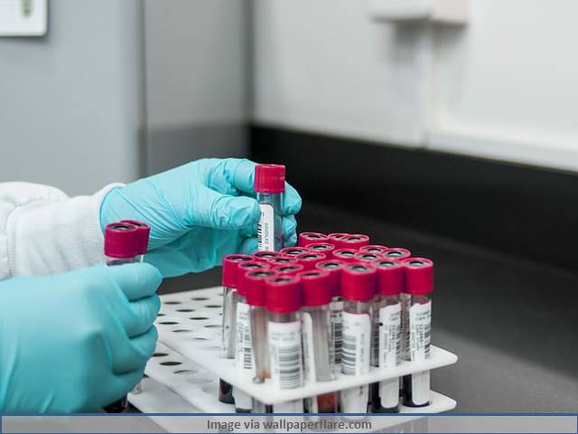 What is Pooled Testing that has been recommended by ICMR to speed up COVID-19 Test Results? – All You Need To Know
